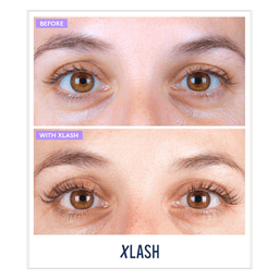 Awakening Eye Gel Patches