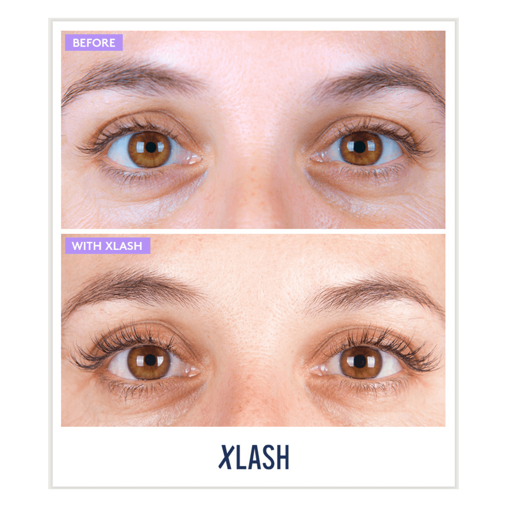 Awakening Eye Gel Patches