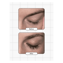 Eyelash Serum