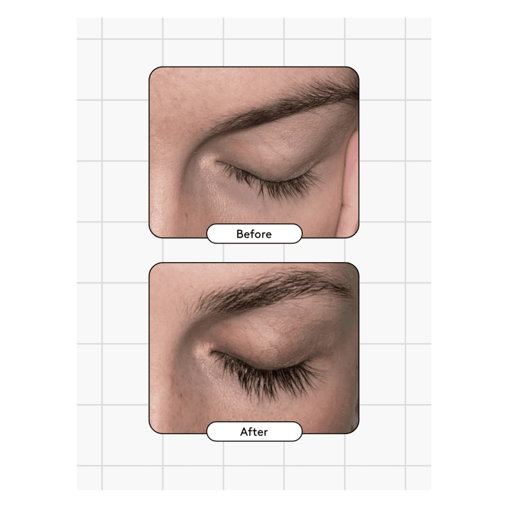 Eyelash Serum