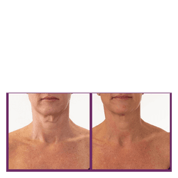 Ageless Throat & Decolletage Creme