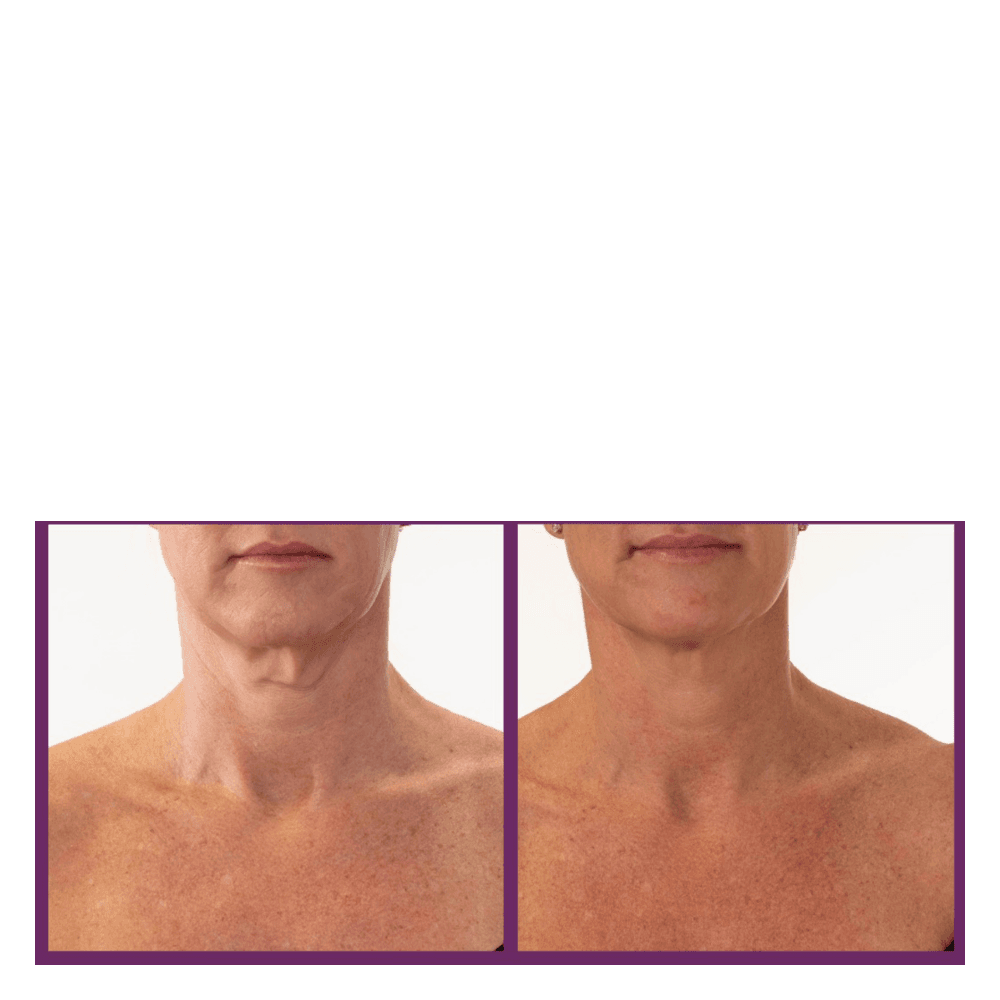 Ageless Throat & Decolletage Creme