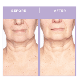 Ageless Throat & Decolletage Creme