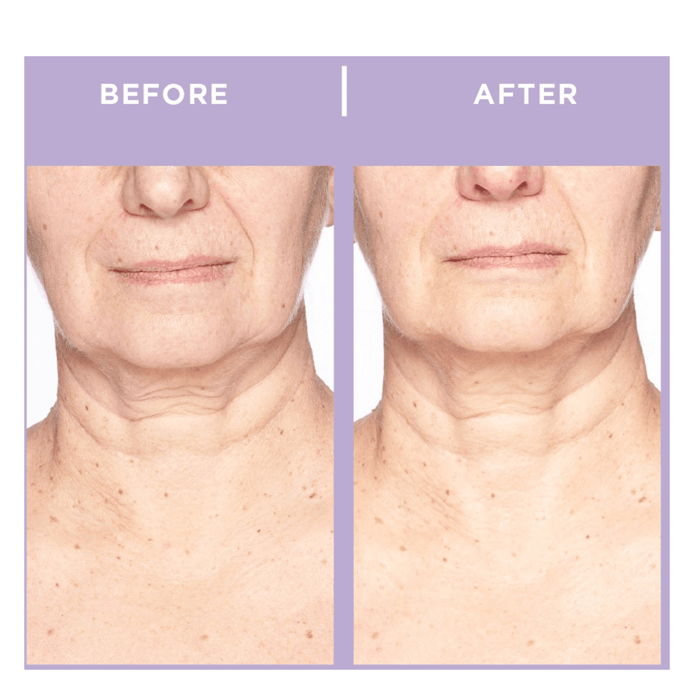 Ageless Throat & Decolletage Creme