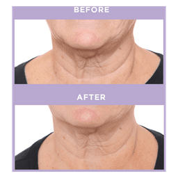 Ageless Throat & Decolletage Creme