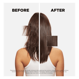 Genesis Anti Hair Fall Serum Hair Serum
